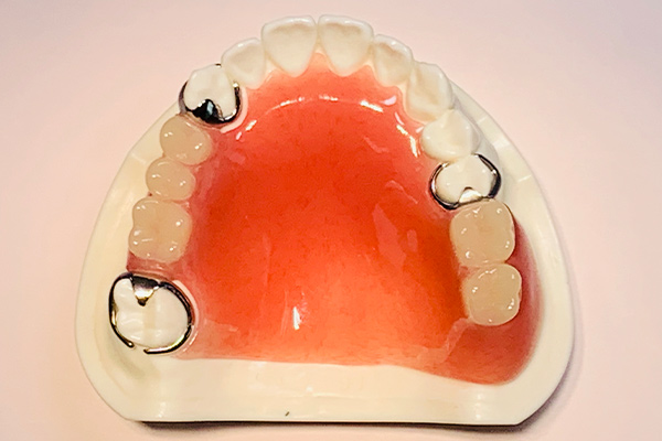 レジン（プラスチック）床義歯