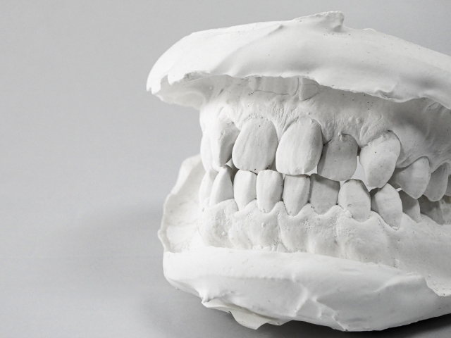 歯と歯が重なっている部分のリスクについて