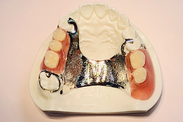コバルトクローム床義歯